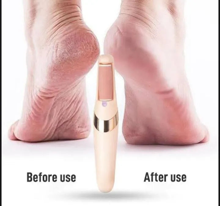 Electric Foot Callus Remover Pedicure Kit