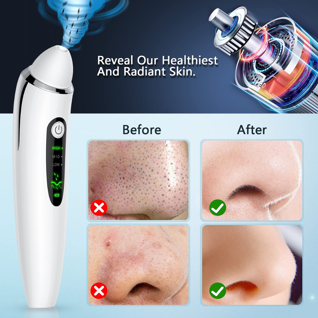 Face Vacuum Suction Blackhead Remover Machine | Deep Cleansing For Nose & Face