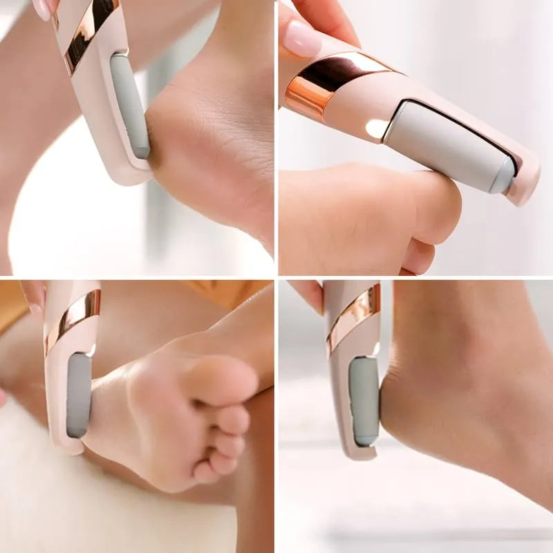 Electric Foot Callus Remover Pedicure Kit